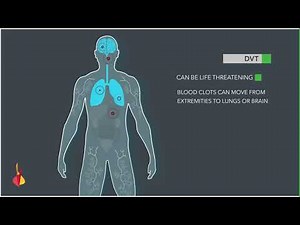 Deep vein thrombosis (DVT)