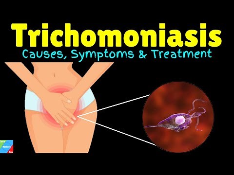 Trichomoniasis: Causes, Symptoms, Diagnosis, Treatments and prevention - STI/STD