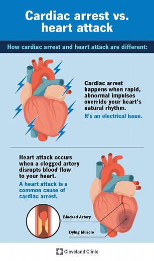 Can You Survive Cardiac Arrest?